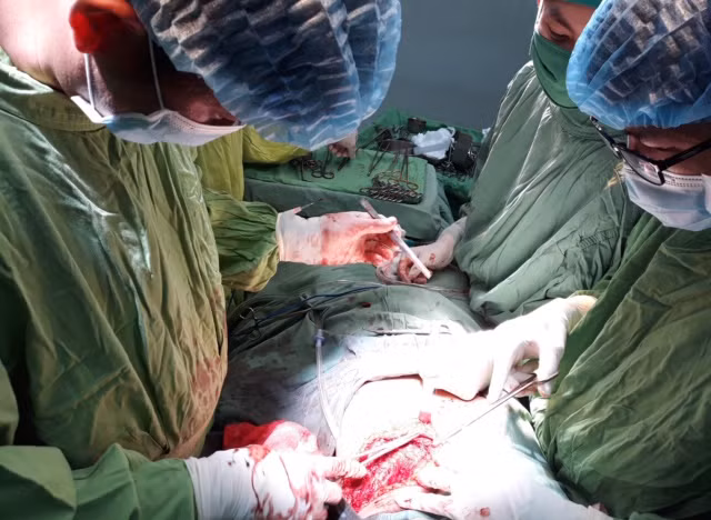 Các BS đang phẫu thuật cho 2 bệnh nhân bị đâm thủng tim. Các BS đang phẫu thuật cho 2 bệnh nhân bị đâm thủng tim.