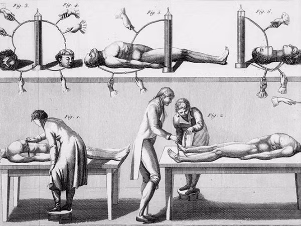 Ngày 17-1-1803, tử tù trẻ tuổi có tên George Forster bị treo cổ tại trại giam Newgate ở London (Anh). Sau khi hành hình, giống như nhiều trường hợp tương tự, xác tử tù này được đưa đến Đại học Phẫu thuật Hoàng gia để thực hiện thí nghiệm rùng rợn.