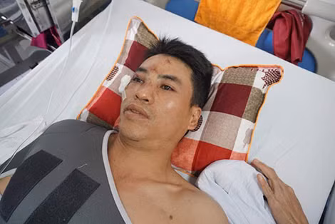 Một nạn nhân trong vụ “xe điên” trên phố Trích Sài bị chấn thương rất nặng ở vùng ngực. Một nạn nhân trong vụ “xe điên” trên phố Trích Sài bị chấn thương rất nặng ở vùng ngực.