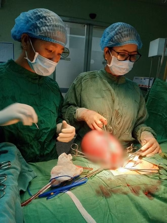 Các BS đang bóc tách khối u xơ nặng gần 5kg ra khỏi người bệnh nhân L.