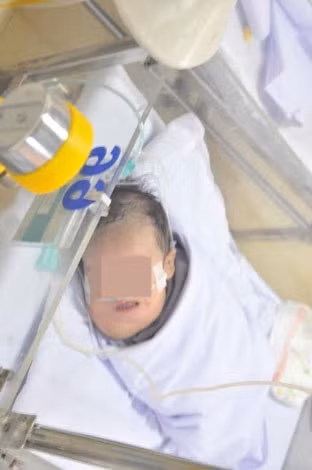 Hai bé trai đang được chăm sóc tại khoa Nhi sơ sinh bệnh viện trước khi được điều trị bằng phương pháp chích thuốc, không cần phẫu thuật.