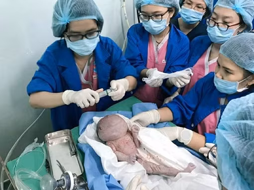 Mổ cứu sống bé sơ sinh non tháng có khối u khổng lồ
