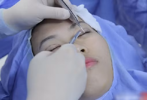 Khuyến cáo người dân chọn cơ sở dịch vụ thẩm mỹ