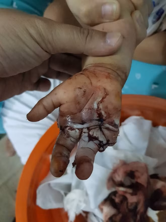 Bàn tay được nối lại đã ấm dần lên.