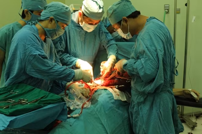 Các bác sĩ phẫu thuật, bóc tách khối u trong người bệnh nhân.