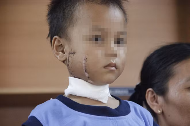 Niềm vui của hai mẹ con sau khi phẫu thuật thành công