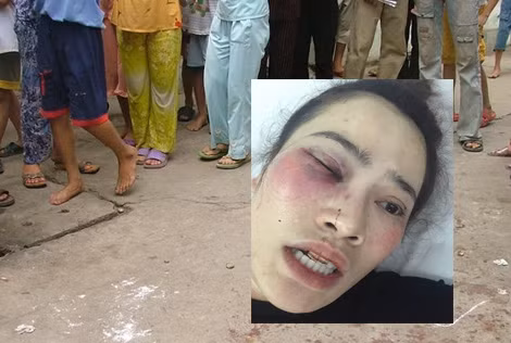 Nam sinh viên đánh phụ nữ nhập viện tại quán bánh xèo