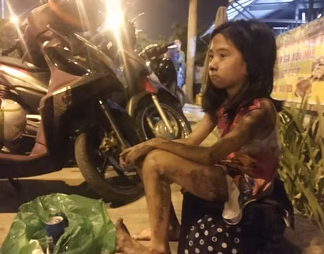 Một bé gái thoát khỏi đám cháy. Ảnh vne