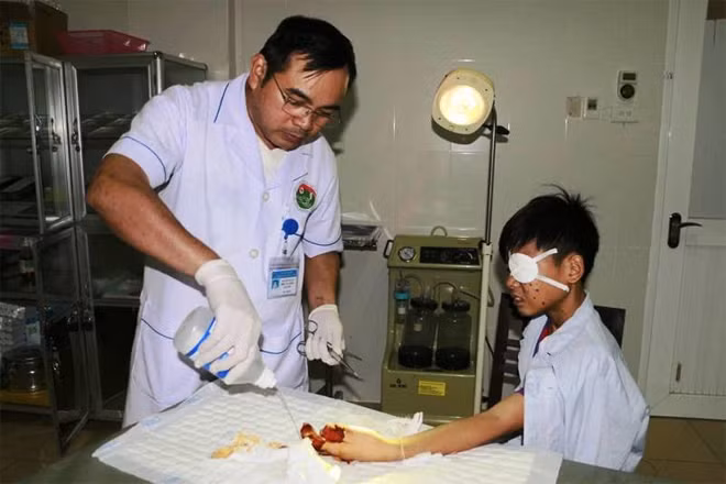Em Nguyễn Văn Nhật bị thương tích rất nặng ở mắt và tay do chơi kíp mìn và nó phát nổ.