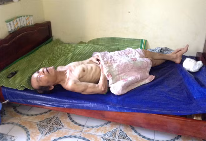 Ông Ký nằm trên giường.