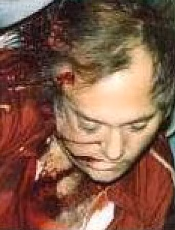 Barry chết vì 3 phát đạn bắn vào đầu và cổ.