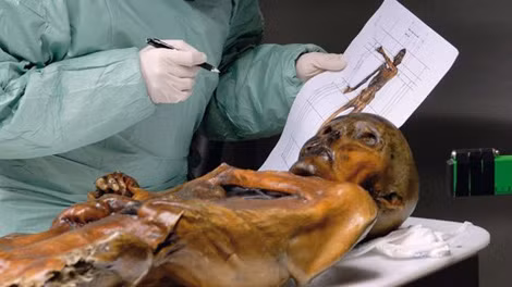 Nghiên cứu xác ướp Otzi trong tình trạng tốt. Nghiên cứu xác ướp Otzi trong tình trạng tốt.