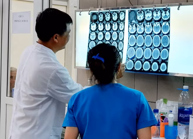 Hình ảnh cho thấy não bệnh nhân bị xuất huyết