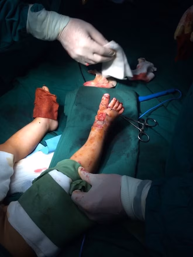 Các bác sĩ phẫu thuật cho bệnh nhi.