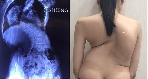 Bệnh viện Việt Đức khám, tư vấn miễn phí các bệnh thường gặp ở trẻ em ảnh 3