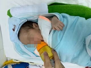 Bệnh nhi 1 tuần sau phẫu thuật