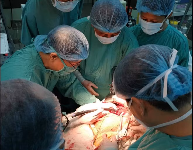 GS.TS Phạm Như Hiệp, Giám đốc Bệnh viện T.Ư Huế cùng êkip thực hiện ca phẫu thuật cắt gan bằng kỹ thuật bảo tồn phần gan cắt bỏ cho bệnh nhân T.
