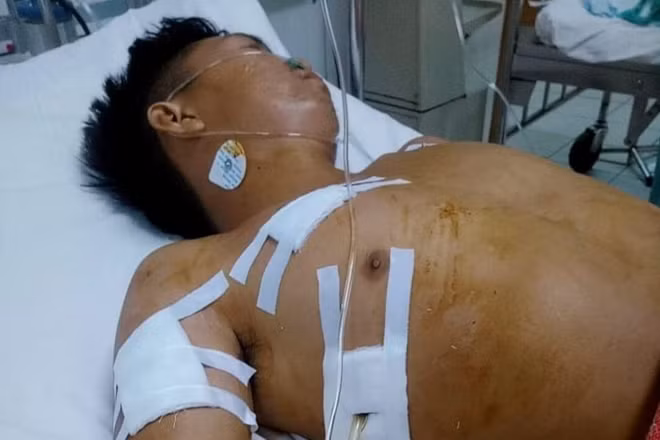 Anh Nguyễn Lầm bị Hưng đâm trọng thương đang nằm điều trị tại Bệnh viện.