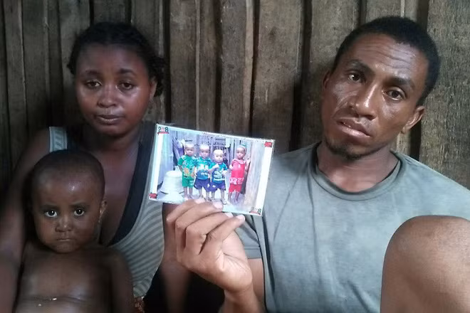 Một gia đình ở Madagascar có con tử vong vì bệnh sởi.