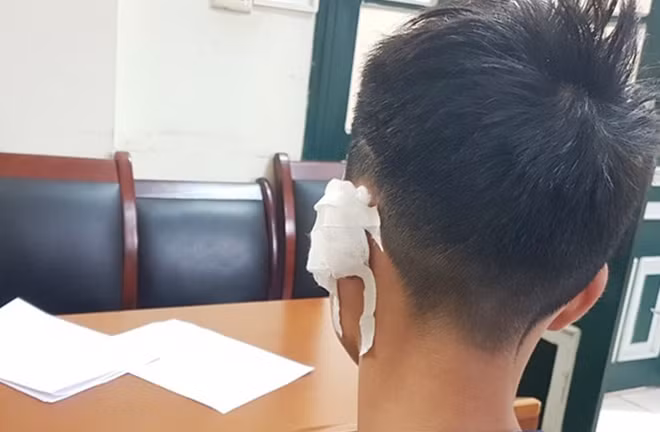 Một lái xe grab bị đối tượng Phạm Văn Lực chém bị thương ở tai.