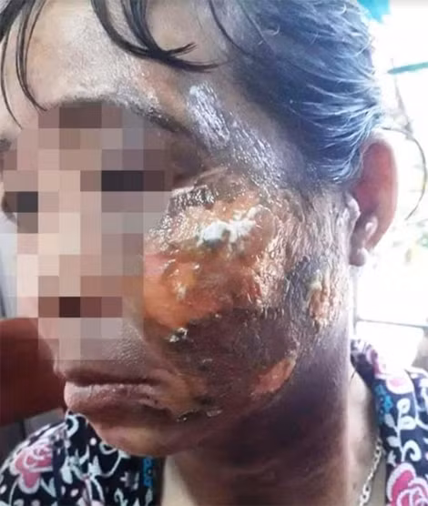 Nạn nhân đã được đi cấp cứu.