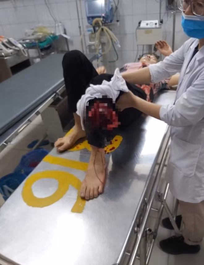 Bà Ngà đang được các bác sĩ ở Bệnh viện 103 Hà Đông phẫu thuật gẫy ống đồng chân trái.