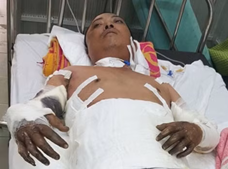 Anh Hà Văn Thiện đang nằm cấp cứu tại Bệnh viện TW Huế.