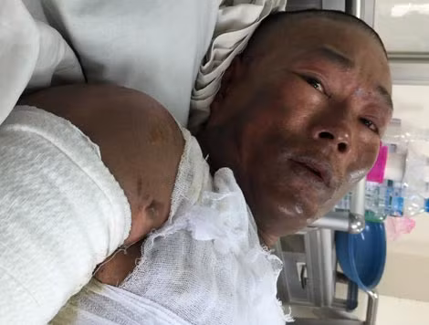 Anh Tình đau đớn kể lại câu chuyện.