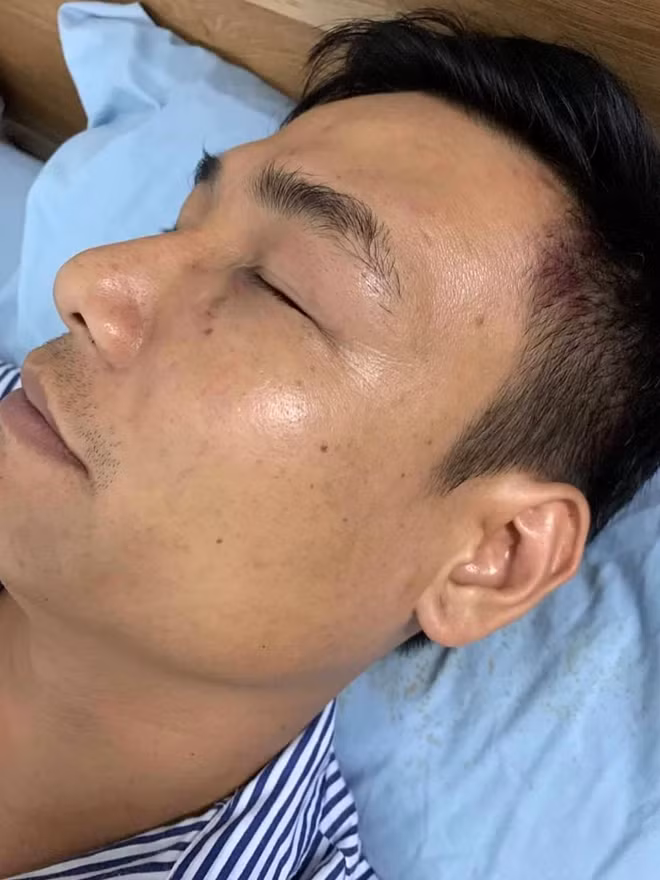 Anh Nguyễn Tiến Thành dan điều trị tại bệnh viện với thương tích ở đầu