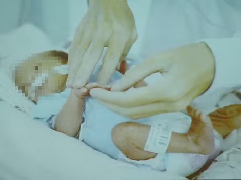 Dù chỉ nặng 1,5kg nhưng cháu bé đang triển tốt, không phải thở máy.