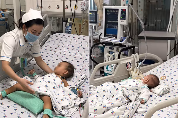 Bé P đang được theo dõi tại Khoa Hồi sức tích cực BV Nhi Đồng Thành phố. Bé P đang được theo dõi tại Khoa Hồi sức tích cực BV Nhi Đồng Thành phố.