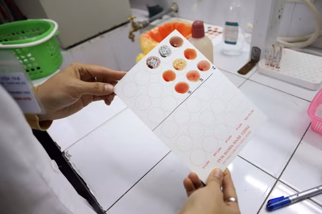 Kỹ thuật viên kiểm tra, phân định nhóm máu của người hiến.