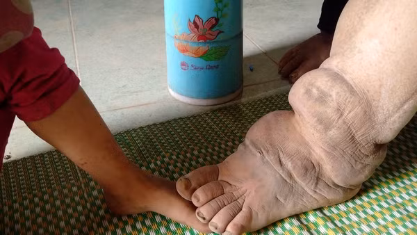 Bàn chân của chị Tỉnh xù xì kỳ lạ.