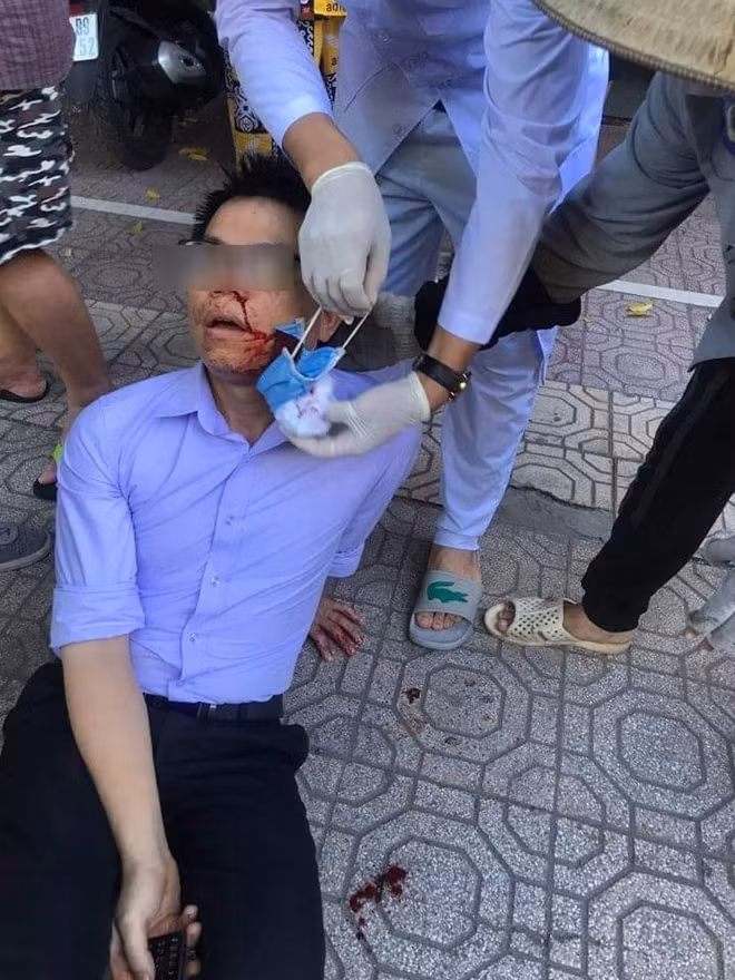 Anh V.V.P bị đánh chảy máu mũi.