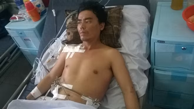 Anh Lê đã thoát hiểm nhờ được phẫu thuật đúng qui trình kịp thời, đang được chăm sóc tại bệnh viện quận Thủ Đức