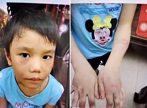Cháu bé sau khi được giải thoát.