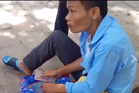 Người thanh niên với bắp chân hoại tử xin tiền khắp Hà Nội. Người thanh niên với bắp chân hoại tử xin tiền khắp Hà Nội.