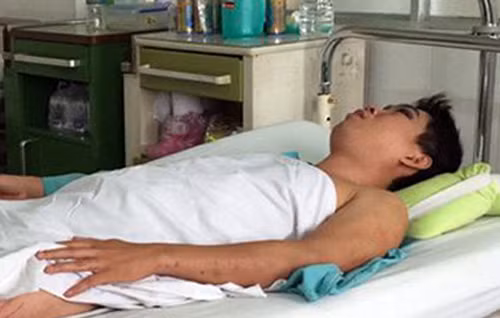 Anh Vang đang điều trị tại bệnh viện. Ảnh: V.S