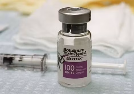 Botox là chất làm đầy được sử dụng phổ biến.