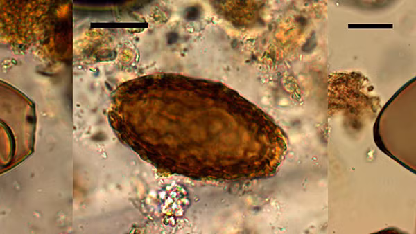 Trứng sán dây cá (trái), giun thận khổng lồ (giữa) và giun Echinostoma (phải) tìm thấy từ cuộc khai quật Must Farm. Ảnh: Đại học Cambridge.