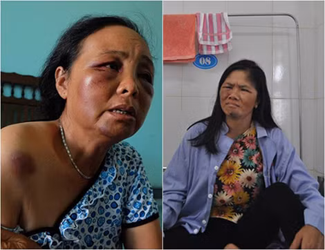 Hai phụ nữ bị đánh ở Sóc Sơn vì nghi bắt cóc trẻ em.