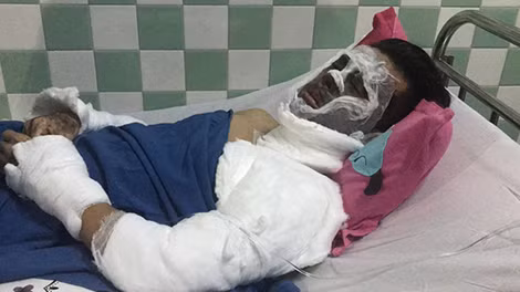 Đêm 14-2 anh Võ Duy Nghiêm được đưa ra nước ngoài điều trị.