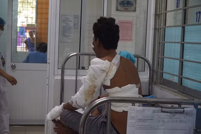 Các ngư dân bị trọng thương đang được điều trị tại Khoa bỏng BV Đà Nẵng.