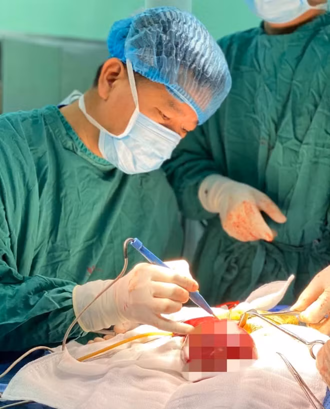 Các bác sĩ đang phẫu thuật cắt khối u máu khổng lồ cho bệnh nhi