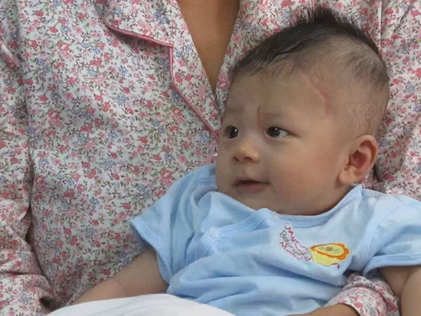 Bé trai Dương Minh Phát trong ngày tái khám 5/11.