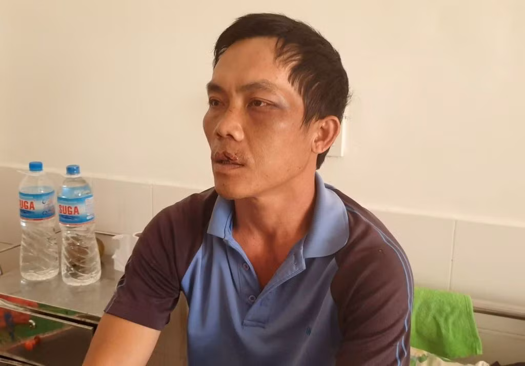 Xử lý nghiêm vụ Giám đốc nhà máy gạch đánh công nhân ảnh 3