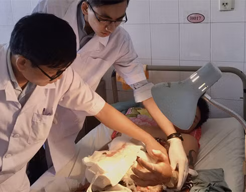 Ba ngày sau ca phẫu thuật cấp cứu và điều trị, các ngón tay của bệnh nhân đã cử động được, bàn tay ấm hồng, tiên lượng tốt. Ảnh: Thảo Ly