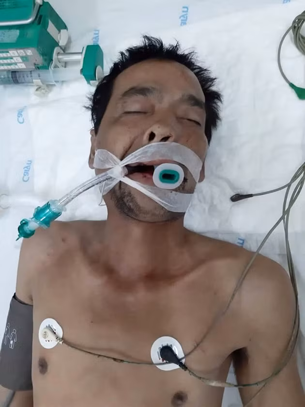 Bệnh nhân đang được cấp cứu trong tình trạng hôn mê sâu do đa chấn thương. Ảnh : BVĐK Khánh Hòa