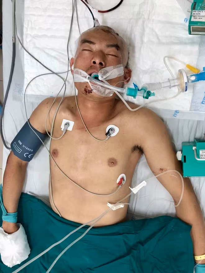 Bệnh nhân đang được cấp cứu tại Bệnh viện đa khoa tỉnh Khánh Hòa. Ảnh: BVĐKKH