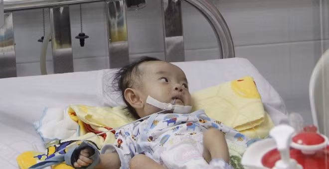 Bé gái N đã hồi phục mạnh mẽ sau ca phẫu thuật.